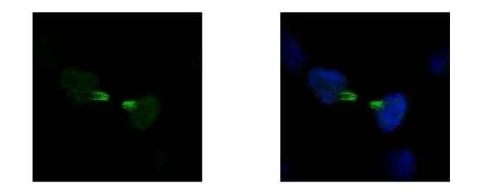 Immunocytochemistry/ Immunofluorescence KIF22 Antibody