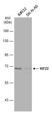 Western Blot KIF22 Antibody