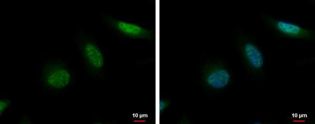 MCAK antibody [N1N3] detects MCAK protein at nucleus by immunofluorescent analysis.Sample: HeLa cells were fixed in 4% paraformaldehyde at RT for 15 min.Green: MCAK protein stained by MCAK antibody [N1N3] (NBP2-17054) diluted at 1:500.Blue: Hoechst 33342 staining. 