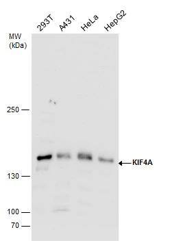 KIF4A antibody detects KIF4A protein by western blot analysis. Various whole cell extracts (30 ug) were separated by 5% SDS-PAGE, and the membrane was blotted with KIF4A antibody (NBP2-17056) diluted by 1:1000. 