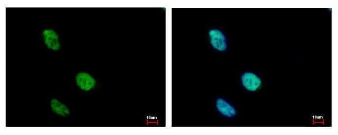 KLHDC4 antibody detects KLHDC4 protein at Nucleus by immunofluorescent analysis. Sample: HeLa cells were fixed in 4% paraformaldehyde at RT for 15 min.Green: KLHDC4 protein stained by KLHDC4 antibody (NBP2-17073) diluted at 1:500.Blue: Hoechst 33343 staining. 