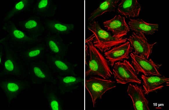 SUV39H1 antibody [N3C3] detects SUV39H1 protein at nucleus by immunofluorescent analysis.Sample: HeLa cells were fixed in 4% paraformaldehyde at RT for 15 min.Green: SUV39H1 stained by SUV39H1 antibody [N3C3] (NBP2-17086) diluted at 1:500.Red: phalloidin, a cytoskeleton marker, diluted at 1:200.Scale bar= 10 um. 
