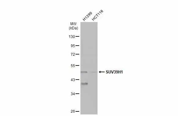 Various whole cell extracts (30 ug) were separated by 10% SDS-PAGE, and the membrane was blotted with SUV39H1 antibody [N3C3] (NBP2-17086) diluted at 1:500. The HRP-conjugated anti-rabbit IgG antibody  was used to detect the primary antibody. 
