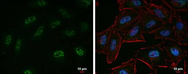 EZH2 antibody detects EZH2 protein at nucleus by immunofluorescent analysis.Sample: HeLa cells were fixed in 4% paraformaldehyde at RT for 15 min.Green: EZH2 protein stained by EZH2 antibody (NBP2-17087) diluted at 1:500.Red: phalloidin, a cytoskeleton marker, diluted at 1:200.Blue: Hoechst 33342 staining.Scale bar = 10 um. 