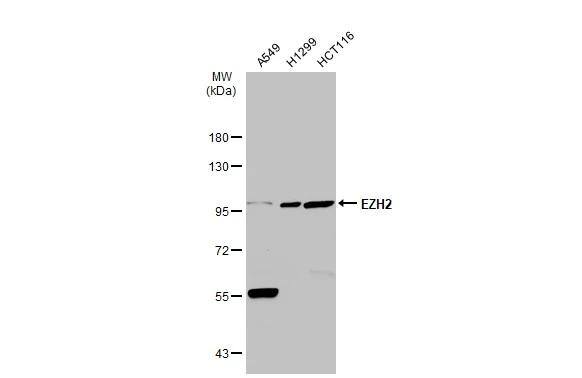 Various whole cell extracts (30 ug) were separated by 7.5% SDS-PAGE, and the membrane was blotted with EZH2 antibody (NBP2-17087) diluted at 1:1000. The HRP-conjugated anti-rabbit IgG antibody  was used to detect the primary antibody. 