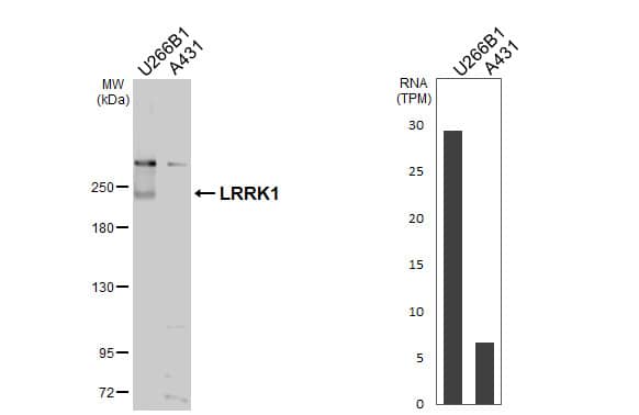 Western Blot LRRK1 Antibody
