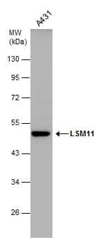 LSM11 antibody detects LSM11 protein by western blot analysis. Whole cell extracts (30 ug) was separated by 10% SDS-PAGE, and the membrane was blotted with LSM11 antibody (NBP2-17180) diluted at 1:1000. 