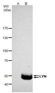 LYN antibody immunoprecipitates LYN protein in IP experiments.IP samples: K562 whole cell extractA. Control with 4 ug of preimmune Rabbit IgGB. Immunoprecipitation of LYN protein by 4 ug LYN antibody (NBP2-17188)5 % SDS-PAGEThe immunoprecipitated LYN protein was detected by LYN antibody (NBP2-17188) diluted at 1:500.[EasyBlot anti-rabbit IgG  was used as a secondary reagent] 