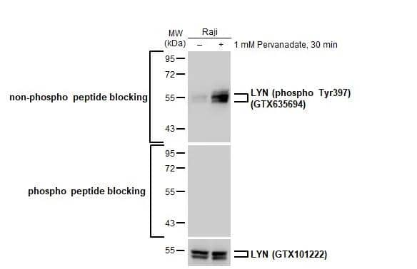 Untreated (-) and treated (+) Raji whole cell extracts (30 ug) were separated by 10% SDS-PAGE, and the membrane was blotted with LYN antibody (NBP2-17188) diluted at 1:1000. The HRP-conjugated anti-rabbit IgG antibody  was used to detect the primary antibody, and the signal was developed with Trident ECL plus-Enhanced. 