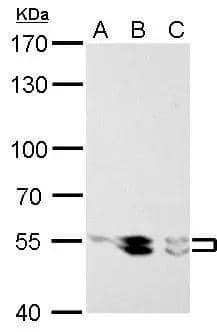 LYN antibody detects LYN protein by Western blot analysis.A. 30 ug Raji whole cell lysate/extractB. 30 ug K562 whole cell lysate/extractC. 30 ug Raji whole cell lysate/extract7.5 % SDS-PAGELYN antibody (NBP2-17188) dilution: 1:1000 