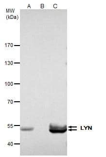 LYN antibody immunoprecipitates LYN protein in IP experiments.IP samples: K562 whole cell extractA. 40 ug K562 whole cell extractB. Control with 4 ug of preimmune Rabbit IgGC. Immunoprecipitation of LYN protein by 4 ug LYN antibody (NBP2-17189)5 % SDS-PAGEThe immunoprecipitated LYN protein was detected by LYN antibody (NBP2-17189) diluted at 1:500.[EasyBlot anti-rabbit IgG  was used as a secondary reagent] 