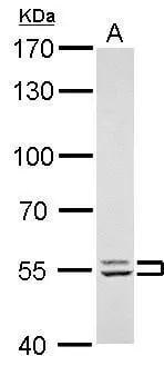 LYN antibody detects LYN protein by Western blot analysis.A. 30 ug THP-1 whole cell lysate/extract7.5 % SDS-PAGELYN antibody (NBP2-17189) dilution: 1:1000 