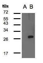 Western Blot analysis of LYPLA1 expression in transfected 293T cell line by LYPLA1polyclonal antibody. A: Non-transfected lysate. B: LYPLA1 transfected lysate. 12% SDS PAGENBP2-17191 diluted at 1:500 