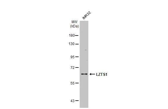 Whole cell extract (30 ug) was separated by 7.5% SDS-PAGE, and the membrane was blotted with LZTS1 antibody [C1C3] (NBP2-17195) diluted at 1:1000. The HRP-conjugated anti-rabbit IgG antibody  was used to detect the primary antibody, and the signal was developed with Trident ECL plus-Enhanced. 