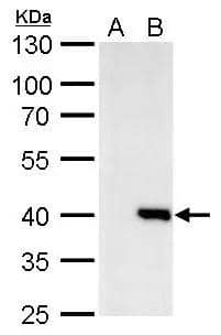 Macro H2A.2 antibody detects Macro H2A.2 protein by Western blot analysis.A. 30 ug 293T whole cell lysate/extractB. 30 ug whole cell lysate/extract of human H2AFY2-transfected 293T cells10 % SDS-PAGEMacro H2A.2 antibody (NBP2-17196) dilution: 1:1000 