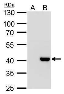 Macro H2A.2 antibody detects Macro H2A.2 protein by Western blot analysis.A. 30 ug 293T whole cell lysate/extractB. 30 ug whole cell lysate/extract of human H2AFY2-transfected 293T cells10 % SDS-PAGEMacro H2A.2 antibody (NBP2-17197) dilution: 1:1000 