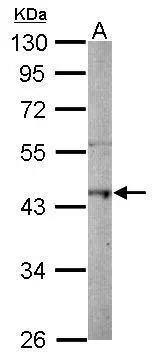 Sample (50 ug of whole cell lysate)  A: mouse brain  10% SDS PAGE  NBP2-17197 diluted at 1:1000  