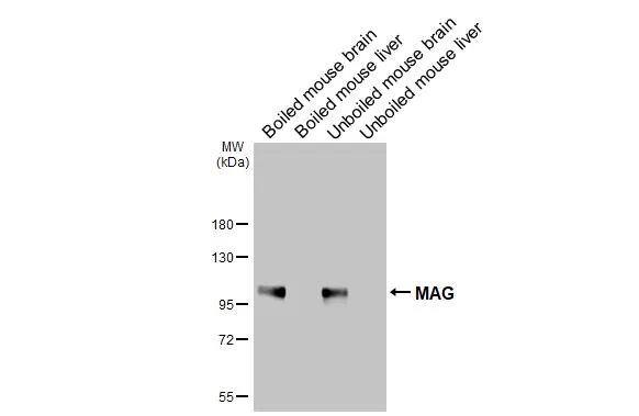 Boiled and unboiled various tissue extracts (50 ug) were separated by 7.5% SDS-PAGE, and the membrane was blotted with MAG antibody (NBP2-17201) diluted at 1:1000. The HRP-conjugated anti-rabbit IgG antibody  was used to detect the primary antibody. 