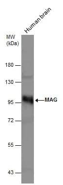 Human tissue extract (30 ug) was separated by 7.5% SDS-PAGE, and the membrane was blotted with MAG antibody (NBP2-17201) diluted at 1:1000. 