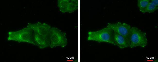 MAGEA4 antibody detects MAGEA4 protein at cytoplasm by immunofluorescent analysis.Sample: A375 cells were fixed in 4% paraformaldehyde at RT for 15 min.Green: MAGEA4 protein stained by MAGEA4 antibody (NBP2-17204) diluted at 1:500.Blue: Hoechst 33342 staining.Scale bar = 10 um. 