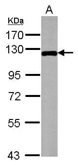 DLK/MAP3K12 antibody detects MAP3K12 protein by Western blot analysis.A. 20 ug mouse embryonic stem cell whole cell lysate/extract 7.5 % SDS-PAGEDLK/MAP3K12 antibody (NBP2-17218) dilution: 1:1000 