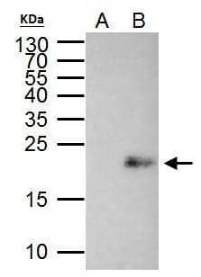 MAX antibody immunoprecipitates MAX protein in IP experiments. IP Sample: 293T whole cell lysate/extract A. Control with 2 ug of preimmune rabbit IgG B. Immunoprecipitation of MAX protein by 2 ug of MAX antibody (NBP2-17233) 15% SDS-PAGE The immunoprecipitated MAX protein was detected by MAX antibody (NBP2-17233) diluted at 1:1000. EasyBlot anti-rabbit IgG  was used as a secondary reagent. 
