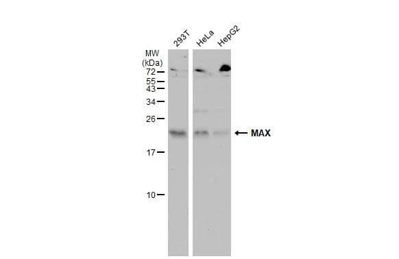 Various whole cell extracts (30 ug) were separated by 15% SDS-PAGE, and the membrane was blotted with MAX antibody (NBP2-17233) diluted at 1:500. The HRP-conjugated anti-rabbit IgG antibody  was used to detect the primary antibody, and the signal was developed with Trident ECL plus-Enhanced. 