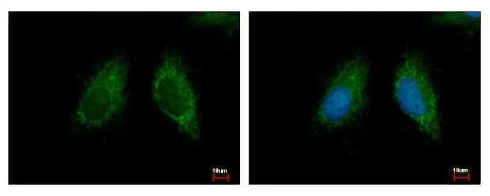 MCCC2 antibody detects MCCC2 protein at Mitochondria by immunofluorescent analysis. Sample: HeLa cells were fixed in 2% paraformaldehyde/culture medium at 37C for 30 min.Green: MCCC2 protein stained by MCCC2 antibody (NBP2-17237) diluted at 1:500.Blue: Hoechst 33343 staining. 