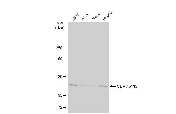 Western Blot: VDP p115 Antibody [NBP2-17245] - Various whole cell extracts (30 ug) were separated by 5% SDS-PAGE, and the membrane was blotted with VDP p115 antibody [N1N2], N-term (NBP2-17245) diluted at 1:1000. The HRP-conjugated anti-rabbit IgG antibody  was used to detect the primary antibody.