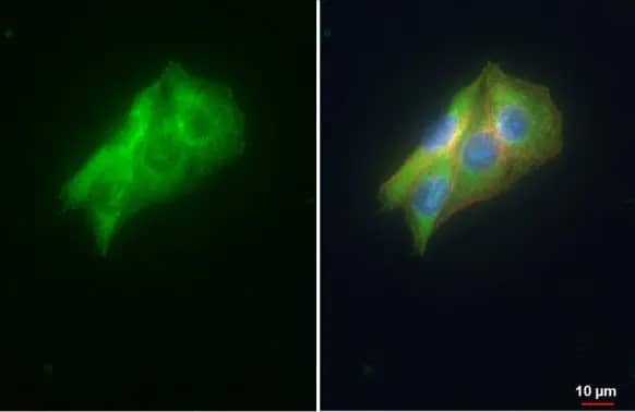 Immunocytochemistry/ Immunofluorescence: VDP p115 Antibody [NBP2-17245] - VDP p115 antibody [N1N2], N-term detects VDP p115  protein at cytoplasm and golgi apparatus by immunofluorescent analysis.Sample: HepG2 cells were fixed in ice-cold MeOH for 5 min.Green: VDP p115  stained by VDP p115 antibody [N1N2], N-term (NBP2-17245) diluted at 1:500.Red: alpha Tubulin, a cytoskeleton marker, stained by alpha Tubulin antibody [GT114]  diluted at 1:1000.Blue: Fluoroshield with DAPI .