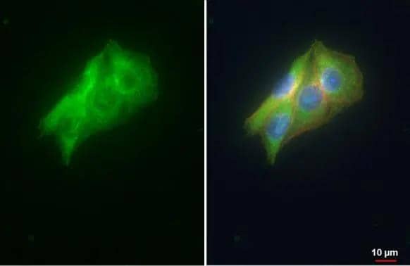 VDP / p115 antibody [N1N2], N-term detects VDP / p115 protein at cytoplasm and golgi apparatus by immunofluorescent analysis.Sample: HepG2 cells were fixed in ice-cold MeOH for 5 min.Green: VDP / p115 stained by VDP / p115 antibody [N1N2], N-term (NBP2-17245) diluted at 1:500.Red: alpha Tubulin, a cytoskeleton marker, stained by alpha Tubulin antibody [GT114]  diluted at 1:1000.Blue: Fluoroshield with DAPI . 
