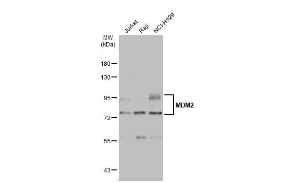 Western Blot: MDM2/HDM2 Antibody [NBP2-17247] - Various whole cell extracts (30 ug) were separated by 7.5% SDS-PAGE, and the membrane was blotted with MDM2/HDM2 antibody (NBP2-17247) diluted at 1:1000. The HRP-conjugated anti-rabbit IgG antibody  was used to detect the primary antibody.