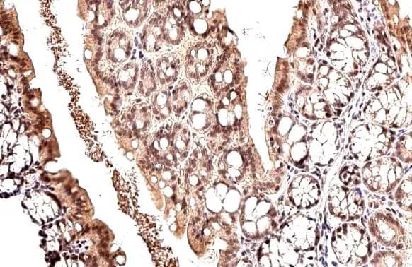 Immunohistochemistry-Paraffin: MDM2/HDM2 Antibody [NBP2-17247] - MDM2/HDM2 antibody detects MDM2/HDM2 protein at nucleus by immunohistochemical analysis.Sample: Paraffin-embedded mouse colon.MDM2/HDM2 stained by MDM2/HDM2 antibody (NBP2-17247) diluted at 1:500.Antigen Retrieval: Citrate buffer, pH 6.0, 15 min