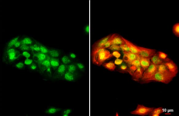 Western Blot: MDM2/HDM2 Antibody [NBP2-17247] - Lack of HIF-P4H-1 increases the amount of p53. (a) Western blot analysis of p53 in wt & Hif-p4h-1−/− MEFs cultured in 21% or 1% O2 for 24 h. (b,c) Western blot analysis of p53 in Hif-p4h-1 & scrambled (Scrm) siRNA transfected HEK293 cells (b) & wt MEFs treated with 50 µM FG4497 for 24 h (c). (d) qPCR analysis of p53 mRNA in wt & Hif-p4h-1−/− MEFs cultured in 21% or 1% O2 for 24 h. (e) Analysis of p53 protein turnover rate. Hif-p4h-1−/− & wt MEFs were treated with 200 μg/ml of cycloheximide for the indicated time points & whole cell lysates were blotted for p53. (f) Western blot analysis of MDM2 in wt & Hif-p4h-1−/− MEFs cultured in 21% or 1% O2 for 24 h. (g) Western blot analysis of p53 & MDM2 in wt MEFs treated with 10 μM nutlin-3a for 24 h with or without overexpression of human HIF-P4H-1 (OE). (h,i) Western blot analysis of HIF1 alpha  in wt & Hif-p4h-1−/− MEFs cultured in 21% or 1% O2 for 24 h (h) & in scrambled & Hif-p4h-1 siRNA transfected HEK293 cells (i). (j) Western blot analysis of ubiquitination of p53 in Hif-p4h-1 & scrambled siRNA transfected HEK293 cells. The cells were transfected with HA-ubiquitin & endogenous p53 was immunoprecipitated followed by Western blotting with anti-HA & anti-P53 antibodies. (k) Western blot analysis of p53 in Hif-p4h-1−/− & wt MEFs were treated with or without 10 μM MG132 for 5 h. Data are presented as representative Western blots & as mean ± s.d., n = at least 3 individual MEF isolates or experiments. *P Sample: HepG2 cells were fixed in 4% paraformaldehyde at RT for 15 min.Green: MDM2/HDM2 stained by MDM2/HDM2 antibody (NBP2-17247) diluted at 1:500.Red: alpha Tubulin, a cytoskeleton marker, stained by alpha Tubulin antibody [GT114]  diluted at 1:1000.Scale bar= 10um.