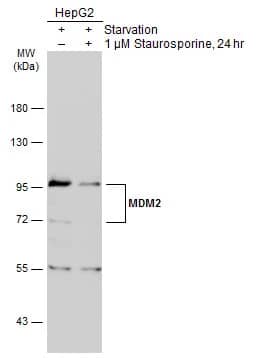 Western Blot: MDM2/HDM2 Antibody [NBP2-17247] - Untreated (-) and treated (+) HepG2 whole cell extracts (30 ug) were separated by 7.5% SDS-PAGE, and the membrane was blotted with MDM2/HDM2 antibody (NBP2-17247) diluted at 1:3000. The HRP-conjugated anti-rabbit IgG antibody  was used to detect the primary antibody.