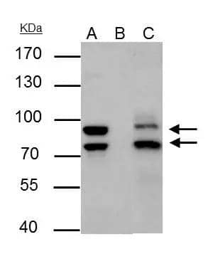MDM2 antibody immunoprecipitates MDM2 protein in IP experiments.IP samples: Jurkat whole cell extractA. 30 ug Jurkat cell whole cell extractB. Control with 4 ug of preimmune Rabbit IgGC. Immunoprecipitation of MDM2 protein by 4 ug MDM2 antibody (NBP2-17247)7.5 % SDS-PAGEThe immunoprecipitated MDM2 protein was detected by MDM2 antibody (NBP2-17247) diluted at 1:500.[EasyBlot anti-rabbit IgG  was used as a secondary reagent] 