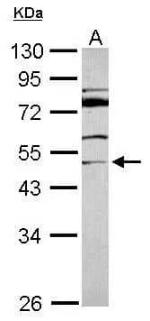 Western Blot: MDS028 Antibody [NBP2-17252] - Sample (30 ug of whole cell lysate)  A: A549   10% SDS PAGE  NBP2-17252 diluted at 1:1000