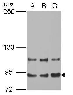Western Blot: MED16 Antibody [NBP2-17255] - Sample (30 ug of whole cell lysate)  A: A431   B: HeLa   C: HepG2   5% SDS PAGE  NBP2-17255 diluted at 1:1000 