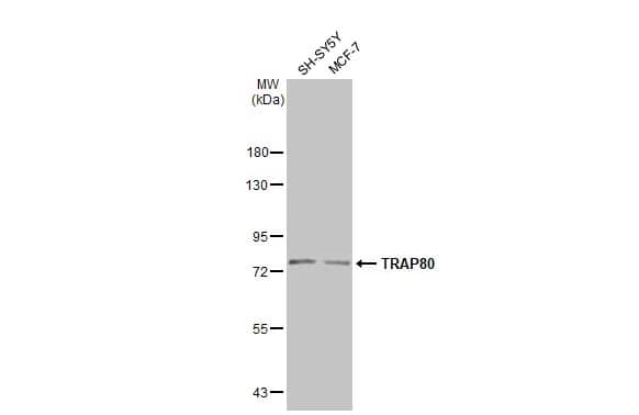Western Blot: MED17 Antibody [NBP2-17256] - Various whole cell extracts (30 ug) were separated by 7.5% SDS-PAGE, and the membrane was blotted with MED17 antibody [C1C3] (NBP2-17256) diluted at 1:1000. The HRP-conjugated anti-rabbit IgG antibody  was used to detect the primary antibody.