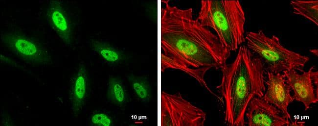 MEF2C antibody detects MEF2C protein at cytoplasm and nucleus by immunofluorescent analysis.Sample: HeLa cells were fixed in 4% paraformaldehyde at RT for 15 min.Green: MEF2C protein stained by MEF2C antibody (NBP2-17260) diluted at 1:1000.Red: phalloidin, a cytoskeleton marker, diluted at 1:200.Scale bar = 10 um. 