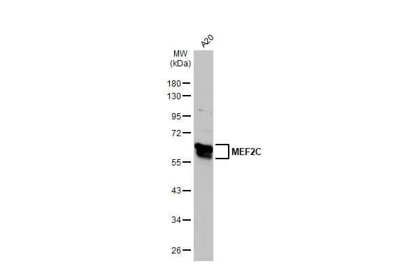 Whole cell extract (30 ug) was separated by 10% SDS-PAGE, and the membrane was blotted with MEF2C antibody (NBP2-17260) diluted at 1:1000. The HRP-conjugated anti-rabbit IgG antibody  was used to detect the primary antibody. 