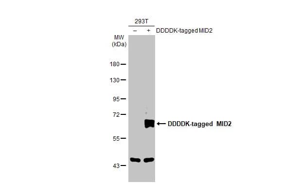 Western Blot: MID2 Antibody [NBP2-17288] - Non-transfected (-) and transfected (+) 293T whole cell extracts (30 ug) were separated by 7.5% SDS-PAGE, and the membrane was blotted with MID2 antibody [C3], C-term (NBP2-17288) diluted at 1:5000. The HRP-conjugated anti-rabbit IgG antibody  was used to detect the primary antibody, and the signal was developed with Trident ECL plus-Enhanced.