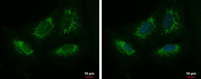 KIAA0391 antibody detects KIAA0391 protein at mitochondria by immunofluorescent analysis.Sample: A549 cells were fixed in 2% paraformaldehyde/culture medium at 37C for 30 min.Green: KIAA0391 protein stained by KIAA0391 antibody (NBP2-17295) diluted at 1:500.Blue: Hoechst 33342 staining.Scale bar = 10 um. 