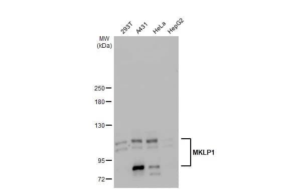 Western Blot: MKLP1 Antibody [NBP2-17299] - Various whole cell extracts (30 ug) were separated by 5% SDS-PAGE, and the membrane was blotted with MKLP1 antibody [N1N2], N-term (NBP2-17299) diluted at 1:2000. The HRP-conjugated anti-rabbit IgG antibody  was used to detect the primary antibody.