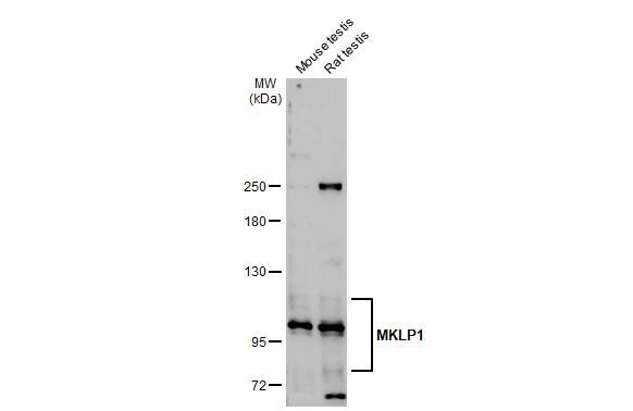 Western Blot: MKLP1 Antibody [NBP2-17299] - Various tissue extracts (50 ug) were separated by 5% SDS-PAGE, and the membrane was blotted with MKLP1 antibody [N1N2], N-term (NBP2-17299) diluted at 1:2000. The HRP-conjugated anti-rabbit IgG antibody  was used to detect the primary antibody.