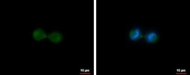 MKLP1 antibody [N1N2], N-term detects MKLP1 protein at midbody by immunofluorescent analysis.Sample: HeLa cells were fixed in 4% paraformaldehyde at RT for 15 min.Green: MKLP1 protein stained by MKLP1 antibody [N1N2], N-term (NBP2-17299) diluted at 1:500.Blue: Hoechst 33342 staining.Scale bar = 10 um. 