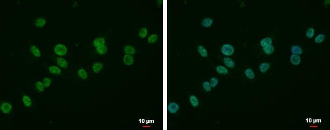 MLLT6 antibody detects MLLT6 protein at nucleus by immunofluorescent analysis.Sample: A375 cells were fixed in 4% paraformaldehyde at RT for 15 min.Green: MLLT6 protein stained by MLLT6 antibody (NBP2-17307) diluted at 1:500.Blue: Hoechst 33342 staining.Scale bar = 10 um. 