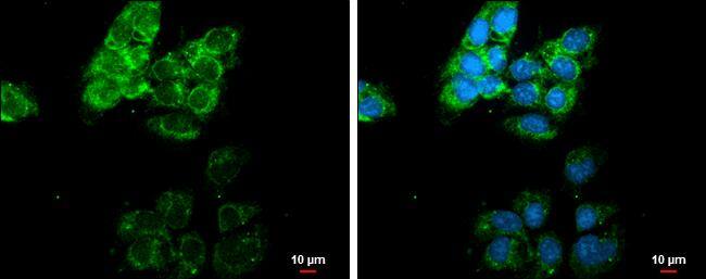 MMP13 antibody [N3C1], Internal detects MMP13 protein at cytoplasm by immunofluorescent analysis.Sample: NT2D1 cells were fixed in ice-cold MeOH for 5 min.Green: MMP13 protein stained by MMP13 antibody [N3C1], Internal (NBP2-17310) diluted at 1:500.Blue: Hoechst 33342 staining.Scale bar = 10 um. 