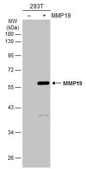 Western Blot MMP-19 Antibody