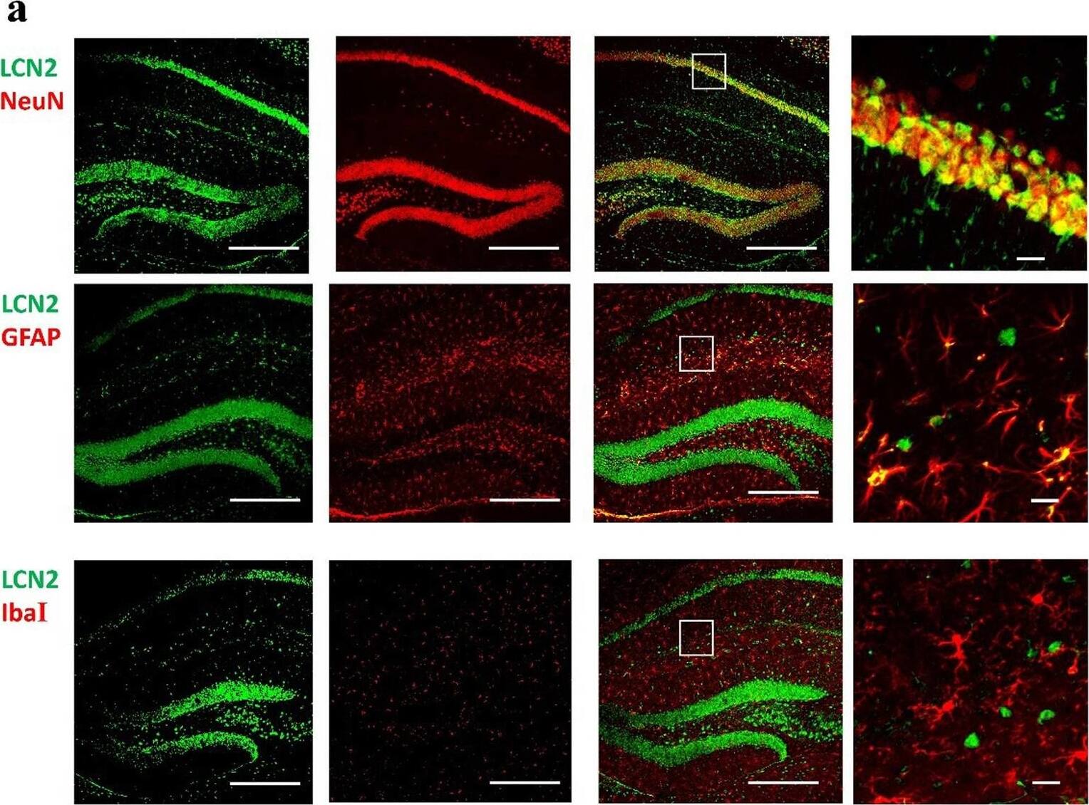 Immunocytochemistry/ Immunofluorescence: AIF-1/Iba1 Antibody [NBP2-19019] - LCN2 mainly expressed on neurons. a Representative immunofluorescence images of LCN2 (green), GFAP (red), NeuN (red) & IbaI (red) staining in sections of the hippocampus after surgery. Long scale bar, 600 µm; short scale bar, 25 µm. b Percentage quantification of LCN2 positive cells (n = 3 mice/group). c Cartoon depicting MACS sorting procedures for isolating CD11b+ & CD11b − cells. d Relative expression of cx3cr1 in CD11b + & CD11b − cells after sorting from all samples. d Relative expression level of Lcn2 mRNA in CD11b + & CD11b − cells from hippocampus 6 h after surgery. e Relative expression level of IL-6 mRNA in CD11b + cells. Data are represented as mean ± SEM. **** P < 0.0001 Image collected & cropped by CiteAb from the following publication (//pubmed.ncbi.nlm.nih.gov/35413913), licensed under a CC-BY license. Not internally tested by Novus Biologicals.